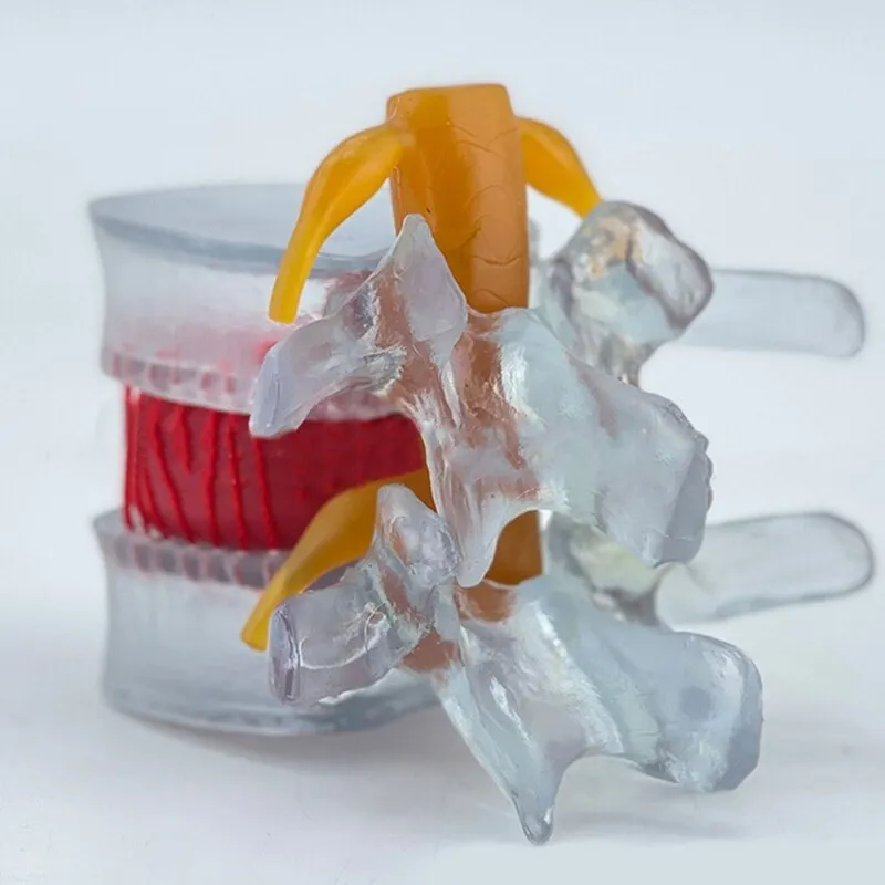 Anatomy Lumbar Spine Model with Movable Lumbar Disc for Demonstrating Pathological Lumbar Disc Lumbar Vertebra Y3NC