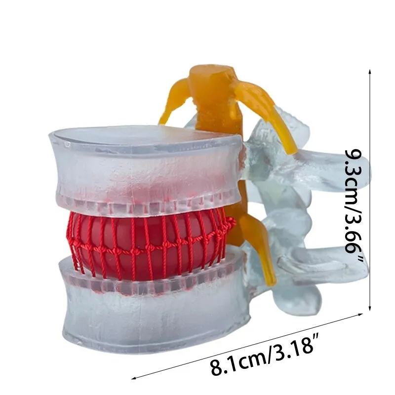 Anatomy Lumbar Spine Model with Movable Lumbar Disc for Demonstrating Pathological Lumbar Disc Lumbar Vertebra Y3NC