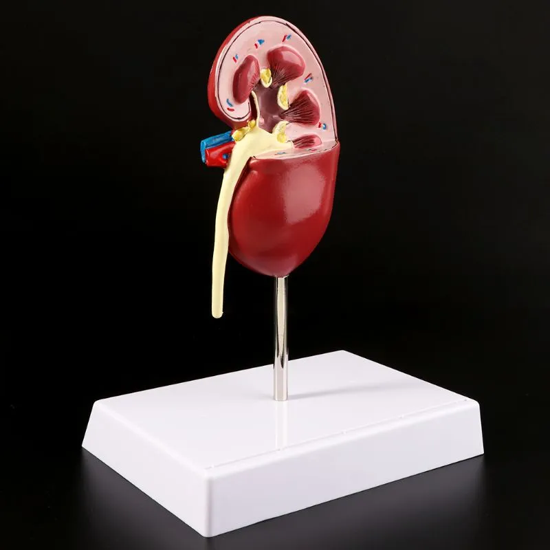 Medical props model Life Size Human Kidney Diseased Model Anatomical Anatomy Diseased Pathological Stone Organ Teaching Supplies