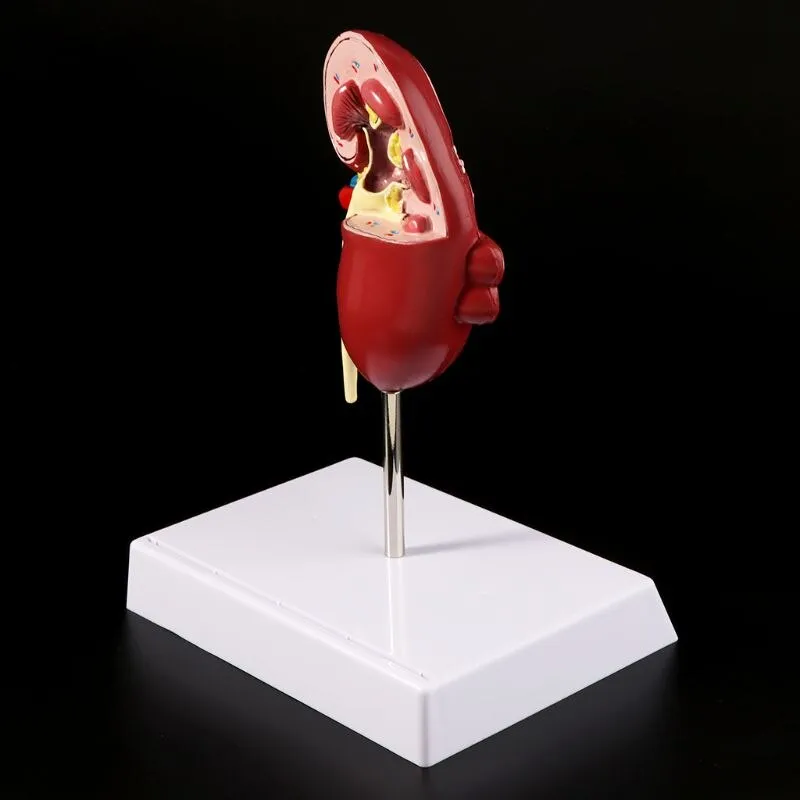 Medical props model Life Size Human Kidney Diseased Model Anatomical Anatomy Diseased Pathological Stone Organ Teaching Supplies