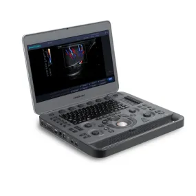 Portable Color Doppler Ultrasound with Probe for B/2B/4B/M/Gynecology and Cardiology Testing Model MSONOX5